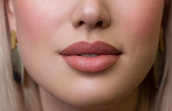 woman's beautiful full lips after lip lift procedure