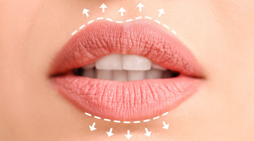 Lip enhancement procedure at Cupid Lips®